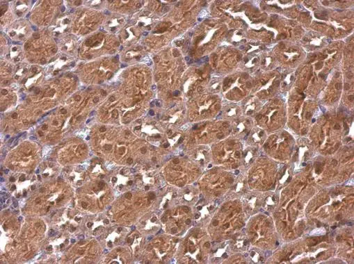 CBWD1 antibody [N2C3] detects CBWD1 protein at cytosol and nucleus on mouse kidney by immunohistochemical analysis. Sample: Paraffin-embedded mouse kidney. CBWD1 antibody [N2C3] (GTX120748) dilution: 1:500. 
 Antigen Retrieval: Trilogy? (EDTA based, pH 8.0) buffer, 15min