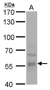 DYNC1LI1 antibody detects DYNC1LI1 protein by western blot analysis. A. 50 μg mouse brain lysate/extract 7.5 % SDS-PAGE DYNC1LI1 antibody (GTX120806) dilution: 1:5000 DYNC1LI1 antibody detects DYNC1LI1 protein by western blot analysis. A. 50 μg mouse brain lysate/extract 7.5 % SDS-PAGE DYNC1LI1 antibody (GTX120806) dilution: 1:5000