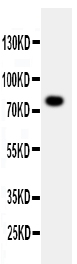 WB analysis of 40ug A549 whole cell lysate using GTX12081 PPP1R15B antibody. Dilution : 0.5 microg/mL WB analysis of 40ug A549 whole cell lysate using GTX12081 PPP1R15B antibody. Dilution : 0.5 microg/mL