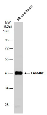 Mouse tissue extract (50 μg) was separated by 10% SDS-PAGE, and the membrane was blotted with FAM46C antibody (GTX120834) diluted at 1:1000. The HRP-conjugated anti-rabbit IgG antibody (GTX213110-01) was used to detect the primary antibody, and the signal was developed with Trident ECL plus-Enhanced.
