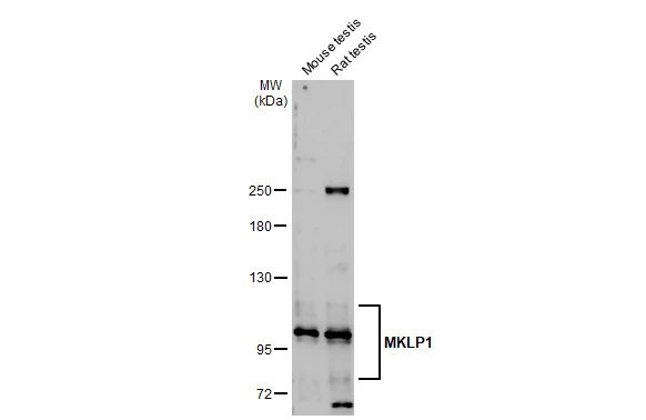Various tissue extracts (50 μg) were separated by 5% SDS-PAGE, and the membrane was blotted with MKLP1 antibody [N1N2], N-term (GTX120875) diluted at 1:2000. The HRP-conjugated anti-rabbit IgG antibody (GTX213110-01) was used to detect the primary antibody.