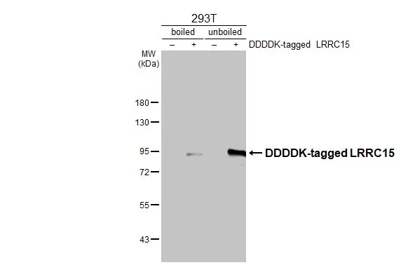 Non-transfected (–) and transfected (+) boiled and unboiled 293T cell extracts (30 μg) were separated by 7.5% SDS-PAGE, and the membrane was blotted with LRRC15 antibody [N1N3] (GTX120895) diluted at 1:2500. The HRP-conjugated anti-rabbit IgG antibody (GTX213110-01) was used to detect the primary antibody.