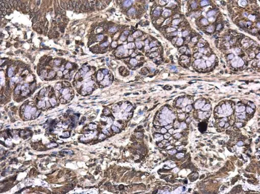 MAGEE2 antibody detects MAGEE2 protein at cytoplasm in rat colon by immunohistochemical analysis. Sample: Paraffin-embedded rat colon. MAGEE2 antibody (GTX120904) diluted at 1:500. Antigen Retrieval: Citrate buffer, pH 6.0, 15 min