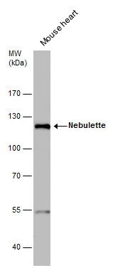Nebulette antibody detects Nebulette protein by western blot analysis. Mouse tissue extracts (50 μg) was separated by 7.5 % SDS-PAGE, and the membrane was blotted with Nebulette antibody (GTX120922) diluted by 1:3000.