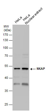 NKAP antibody detects NKAP protein by western blot analysis. HeLa whole cell extracts and nuclear extracts (30 μg) were separated by 10% SDS-PAGE, and the membrane was blotted with NKAP antibody (GTX120929) at a dilution of 1:1000.