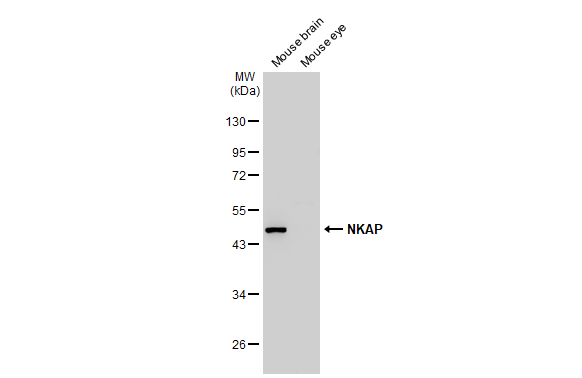 Various tissue extracts (50 μg) were separated by 10% SDS-PAGE, and the membrane was blotted with NKAP antibody (GTX120929) diluted at 1:1000. The HRP-conjugated anti-rabbit IgG antibody (GTX213110-01) was used to detect the primary antibody.
