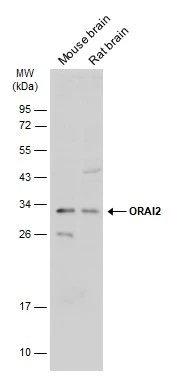 Various tissue extracts (50 μg) were separated by 12% SDS-PAGE, and the membrane was blotted with ORAI2 antibody (GTX120952) diluted at 1:500. The HRP-conjugated anti-rabbit IgG antibody (GTX213110-01) was used to detect the primary antibody.