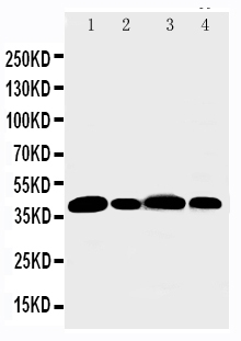 WB analysis of various samples using GTX12105 Aurora B antibody. Lane 1 : rat liver tissue lysate Lane 2 : 22RV cell lysate Lane 3 : HeLa cell lysate Lane 4 : SW620 cell lysate WB analysis of various samples using GTX12105 Aurora B antibody. Lane 1 : rat liver tissue lysate Lane 2 : 22RV cell lysate Lane 3 : HeLa cell lysate Lane 4 : SW620 cell lysate