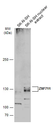 SK-N-SH whole cell and nuclear extracts (30 μg) were separated by 5% SDS-PAGE, and the membrane was blotted with ZNF711 antibody (GTX121177) diluted at 1:500. The HRP-conjugated anti-rabbit IgG antibody (GTX213110-01) was used to detect the primary antibody.