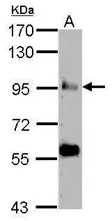 Sample (50 ug of whole cell lysate) A: mosue testis 7.5% SDS PAGE GTX121212 diluted at 1:1000