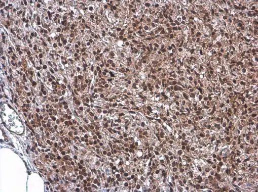 KDM6A antibody [N2C1], Internal detects KDM6A protein at nucleus by immunohistochemical analysis. Sample: Paraffin-embedded mouse lymph node. KDM6A stained by KDM6A antibody [N2C1], Internal (GTX121246) diluted at 1:500. Antigen Retrieval: Citrate buffer, pH 6.0, 15 min