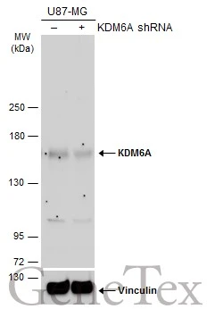 Non-transfected (–) and transfected (+) U87-MG whole cell extracts (60 μg) were separated by 5% SDS-PAGE, and the membrane was blotted with KDM6A antibody [N2C1], Internal (GTX121246) diluted at 1:1000. The HRP-conjugated anti-rabbit IgG antibody (GTX213110-01) was used to detect the primary antibody.