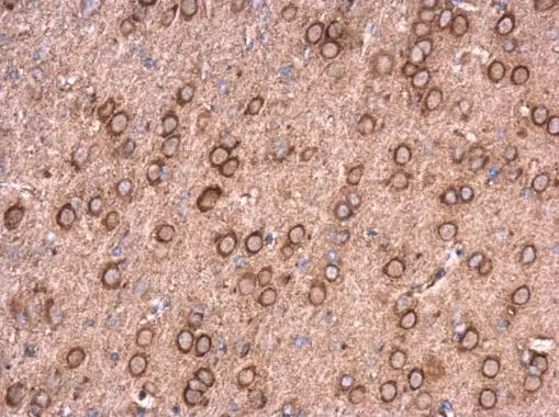 Neurocalcin delta antibody detects Neurocalcin delta protein at cytoplasm in mouse brain by immunohistochemical analysis. Sample: Paraffin-embedded mouse brain. Neurocalcin delta antibody (GTX121264) diluted at 1:500. 
 Antigen Retrieval: Trilogy? (EDTA based, pH 8.0) buffer, 15min