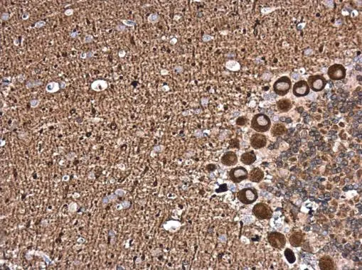 Neurocalcin delta antibody detects Neurocalcin delta protein at cytoplasm in rat brain by immunohistochemical analysis. Sample: Paraffin-embedded rat brain. Neurocalcin delta antibody (GTX121264) diluted at 1:500. 
 Antigen Retrieval: Trilogy? (EDTA based, pH 8.0) buffer, 15min