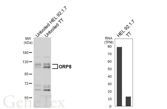Unboiled various whole cell extracts (30 μg) were separated by 7.5% SDS-PAGE, and the membrane was blotted with ORP8 antibody (GTX121273) diluted at 1:1000. The HRP-conjugated anti-rabbit IgG antibody (GTX213110-01) was used to detect the primary antibody. Corresponding RNA expression data for the same cell lines are based on Human Protein Atlas program.