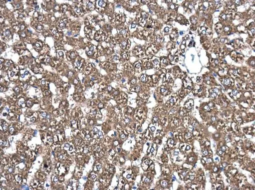 PDIA6 antibody [N1N3] detects PDIA6 protein at cytoplasm in rat liver by immunohistochemical analysis. Sample: Paraffin-embedded rat liver. PDIA6 antibody [N1N3] (GTX121275) diluted at 1:500. 
 Antigen Retrieval: Citrate buffer, pH 6.0, 15 min