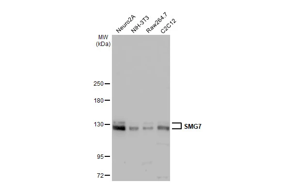 Various whole cell extracts (30 μg) were separated by 5% SDS-PAGE, and the membrane was blotted with SMG7 antibody (GTX121320) diluted at 1:1000. The HRP-conjugated anti-rabbit IgG antibody (GTX213110-01) was used to detect the primary antibody.