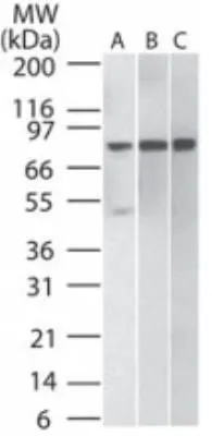 WB analysis of (A) Daudi,B) HeLa,and C) NIH3T3 cell lysate using GTX12139 IKK beta antibody [10AG2]. Dilution : 2 ug/ml