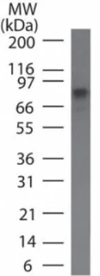 WB analysis of Daudi cell lysate using GTX12140 IKK beta antibody [10A9B6]. Dilution : 5 ug/ml