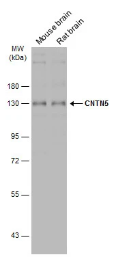 Various tissue extracts (50 μg) were separated by 7.5% SDS-PAGE, and the membrane was blotted with CNTN5 antibody [C1C3] (GTX121400) diluted at 1:500. The HRP-conjugated anti-rabbit IgG antibody (GTX213110-01) was used to detect the primary antibody.