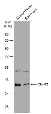 Various tissue extracts (50 μg) were separated by 10% SDS-PAGE, and the membrane was blotted with CGI 62 antibody (GTX121412) diluted at 1:500. The HRP-conjugated anti-rabbit IgG antibody (GTX213110-01) was used to detect the primary antibody.
