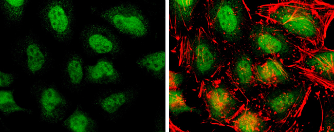 Non-transfected (�) and transfected (+) 293T whole cell extracts (30 ug) were separated by 7.5% SDS-PAGE,and the membrane was blotted with TET3 antibody [C3],C-term (GTX121453) diluted at 1:5000.