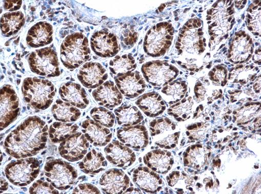 Non-transfected (�) and transfected (+) 293T whole cell extracts (30 ug) were separated by 7.5% SDS-PAGE,and the membrane was blotted with TET3 antibody [C3],C-term (GTX121453) diluted at 1:5000.