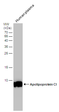 Human tissue extract (50 μg) was separated by 15% SDS-PAGE, and the membrane was blotted with Apolipoprotein CI antibody (GTX121456) diluted at 1:5000. The HRP-conjugated anti-rabbit IgG antibody (GTX213110-01) was used to detect the primary antibody.