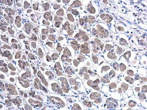 Trefoil factor 1 antibody detects Trefoil factor 1 protein at cytoplasm in mouse stomach by immunohistochemical analysis. Sample: Paraffin-embedded mouse stomach. Trefoil factor 1 antibody (GTX121461) diluted at 1:500. 
 Antigen Retrieval: Citrate buffer, pH 6.0, 15 min