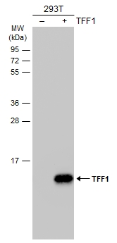 Non-transfected (–) and transfected (+) 293T whole cell extracts (30 μg) were separated by 15% SDS-PAGE, and the membrane was blotted with TFF1 antibody (GTX121461) diluted at 1:1000. The HRP-conjugated anti-rabbit IgG antibody (GTX213110-01) was used to detect the primary antibody.