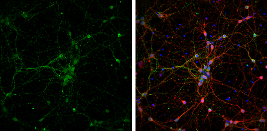 VAMP2 antibody detects VAMP2 protein at synaptic vesicles by immunofluorescent analysis. Sample: DIV9 rat E18 primary cortical neurons were fixed in 4% paraformaldehyde at RT for 15 min. Green: VAMP2 protein stained by VAMP2 antibody (GTX121462) diluted at 1:500. Red: beta Tubulin 3/ Tuj1, stained by beta Tubulin 3/ Tuj1 antibody [GT11710] (GTX631836) diluted at 1:500. Blue: Fluoroshield with DAPI (GTX30920).