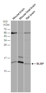 Various tissue extracts (50 μg) were separated by 15% SDS-PAGE, and the membrane was blotted with FABP7 antibody [N1C3] (GTX121467) diluted at 1:1000.