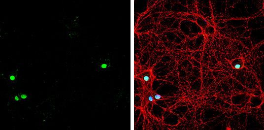 ZBTB20 antibody detects ZBTB20 protein at by immunofluorescent analysis. Sample: DIV9 rat E18 primary hippocampal neuron cells were fixed in 4% paraformaldehyde at RT for 15 min. Green: ZBTB20 stained by ZBTB20 antibody (GTX121616) diluted at 1:500. Red: beta Tubulin 3/ Tuj1, stained by beta Tubulin 3/ Tuj1 antibody [GT1338] (GTX631831) diluted at 1:500. Blue: Fluoroshield with DAPI (GTX30920).
