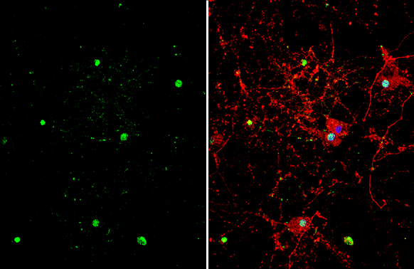 ZBTB20 antibody detects ZBTB20 protein by immunofluorescent analysis. Sample: DIV10 rat E18 primary hippocampal neuron cells were fixed in 4% paraformaldehyde at RT for 15 min. Green: ZBTB20 stained by ZBTB20 antibody (GTX121616) diluted at 1:500. Red: Tau, stained by Tau antibody [GT287] (GTX634809) diluted at 1:500. Blue: Fluoroshield with DAPI (GTX30920).