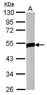 Sample (50 ug of whole cell lysate) A: Rat muscle 10% SDS PAGE GTX121644 diluted at 1:1000 Sample (50 ug of whole cell lysate) A: Rat muscle 10% SDS PAGE GTX121644 diluted at 1:1000