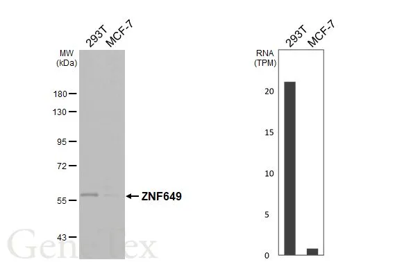 Various whole cell extracts (30 μg) were separated by 7.5% SDS-PAGE, and the membrane was blotted with ZNF649 antibody (GTX121655) diluted at 1:1000. The HRP-conjugated anti-rabbit IgG antibody (GTX213110-01) was used to detect the primary antibody. Corresponding RNA expression data are based on Human Protein Atlas program. Various whole cell extracts (30 μg) were separated by 7.5% SDS-PAGE, and the membrane was blotted with ZNF649 antibody (GTX121655) diluted at 1:1000. The HRP-conjugated anti-rabbit IgG antibody (GTX213110-01) was used to detect the primary antibody. Corresponding RNA expression data are based on Human Protein Atlas program.