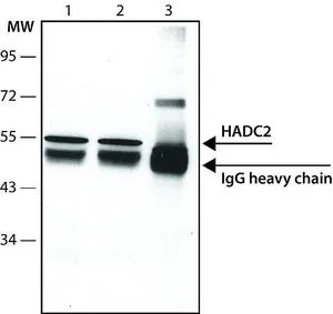 ICC/IF analysis of HeLa cells using GTX12169 HDAC2 antibody [HDAC2-62] at 10 ug/mL. Cells were fixed and permeabilized with cold methanol followed by cold methanol:acetone.
