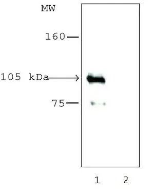 IP analysis of HEK293T cells expressing DDDDK-tagged human HDAC7. The precipitated hHDAC7 protein was detected using anti-DDDDK Tag antibody.