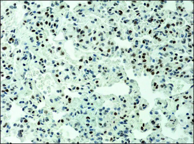 IHC-P analysis of mouse liver tissue using GTX12178 Histone H3K9ac (acetyl Lys9) antibody at 0.1 ug/mL.