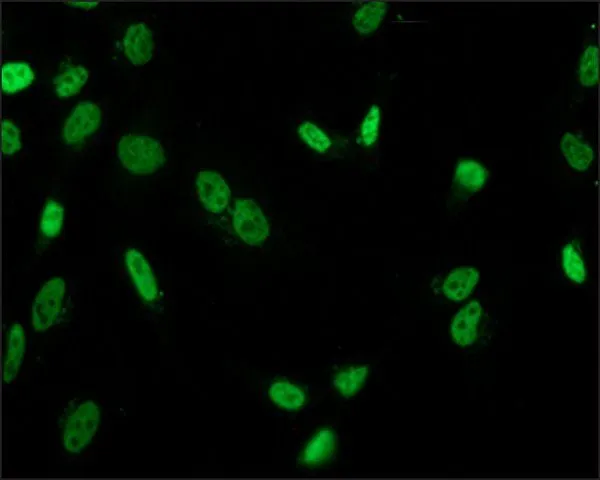 WB analysis of serum and sodium butyrate-treated NIH3T3 cell lysate using GTX12181 Histone H3K9acS10ph (phospho Ser10,acetyl Lys9) antibody.