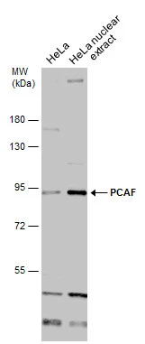 HeLa whole cell and nuclear extracts (30 microg) were separated by 7.5% SDS-PAGE, and the membrane was blotted with PCAF antibody [C3], C-term (GTX12188) diluted at 1:1000.