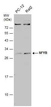 Various whole cell extracts (30 μg) were separated by 12% SDS-PAGE, and the membrane was blotted with NFYB antibody (GTX121922) diluted at 1:1000. The HRP-conjugated anti-rabbit IgG antibody (GTX213110-01) was used to detect the primary antibody.