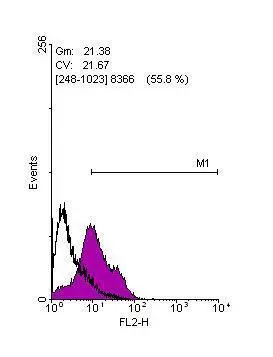 Immunohistochemical analysis of paraffin-embedded human gastric cancer,using Lin28A antibody(GTX121923) antibody at 1:500 dilution. Antigen Retrieval: Trilogy? (EDTA based,pH 8.0) buffer,15min