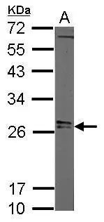 Sample (20 μg of whole cell lysate) A: mouse ESC 12% SDS PAGE GTX121923 diluted at 1:3000 The HRP-conjugated anti-rabbit IgG antibody (GTX213110-01) was used to detect the primary antibody.