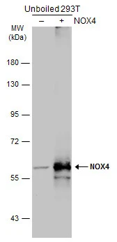 Non-transfected (–) and transfected (+) unboiled 293T whole cell extracts (30 μg) were separated by 7.5% SDS-PAGE, and the membrane was blotted with NOX4 antibody [N3C3] (GTX121929) diluted at 1:500. The HRP-conjugated anti-rabbit IgG antibody (GTX213110-01) was used to detect the primary antibody.