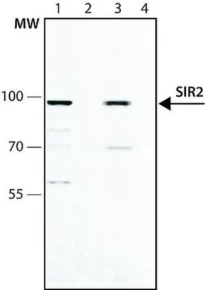 WB analysis of (lanes 1-2) HeLa nuclear extract (lanes 3-4) of HCT-116 cell lysate using GTX12193 SIRT2 antibody. Lane 1, 3 : Antibody 1 microg/mL Lane 2, 4 : Antibody 1 microg/mL + Sir2 immunizing peptide