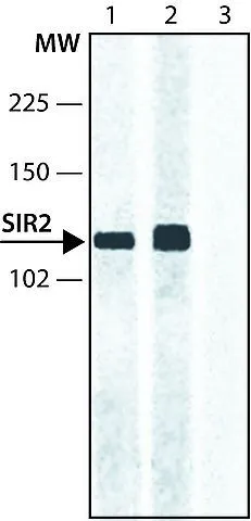 WB analysis of NIH3T3 cell lysate using GTX12193 SIRT2 antibody. Lane 1 : Antibody 0.25 microg/mL Lane 2 : Antibody 0.5 microg/mL Lane 3 : Negative control: without first antibody