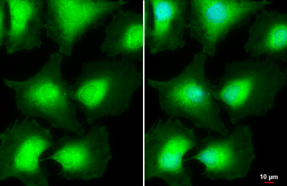 AKT antibody [N3C2],Internal detects AKT protein at cytoplasm by immunofluorescent analysis.