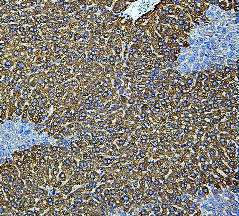 IHC-P analysis of mouse liver tissue using GTX12194 CYP2E1 antibody. Antigen retireval : Heat mediated antigen retrieval was performed in citrate buffer (pH6, epitope retrieval solution) for 20 mins Dilution : 1microg/ml IHC-P analysis of mouse liver tissue using GTX12194 CYP2E1 antibody. Antigen retireval : Heat mediated antigen retrieval was performed in citrate buffer (pH6, epitope retrieval solution) for 20 mins Dilution : 1microg/ml