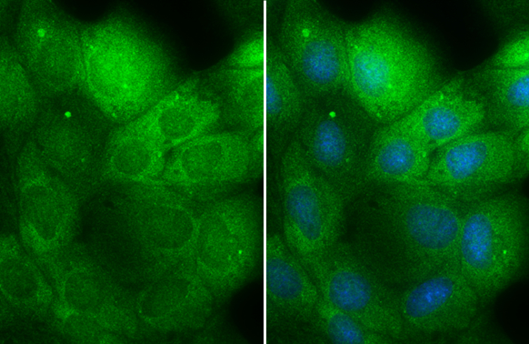 MEK1 + MEK2 antibody detects MEK1 + MEK2 protein at cytoplasm and nucleus by immunofluorescent analysis. Sample: MDCK cells were fixed in 4% paraformaldehyde at RT for 15 min. Green: MEK1 + MEK2 stained by MEK1 + MEK2 antibody (GTX121942) diluted at 1:500. Blue: Hoechst 33342 staining.